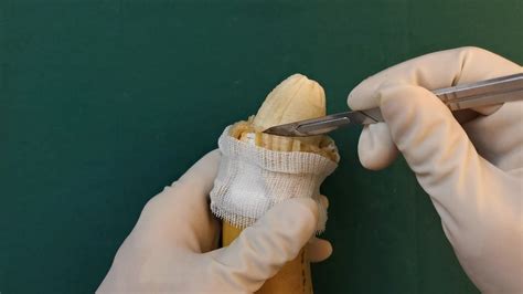 penis photo|Circumcision Picture and Photo Gallery